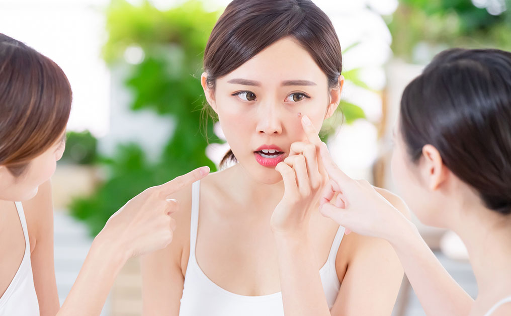 5個壞習慣致狂出油脂粒 針清油脂粒並不可行 必讀去油脂粒最佳方法及去油脂粒產品推介